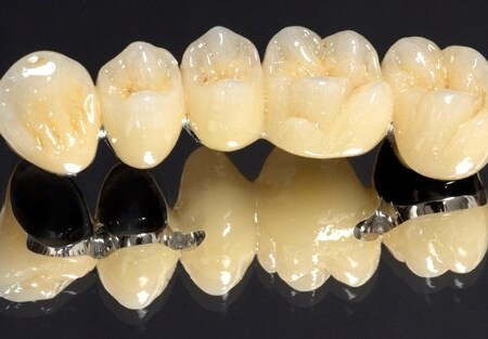 Răng sứ Crom - Coban